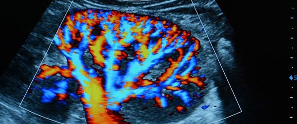 ultrassonografia com dopler